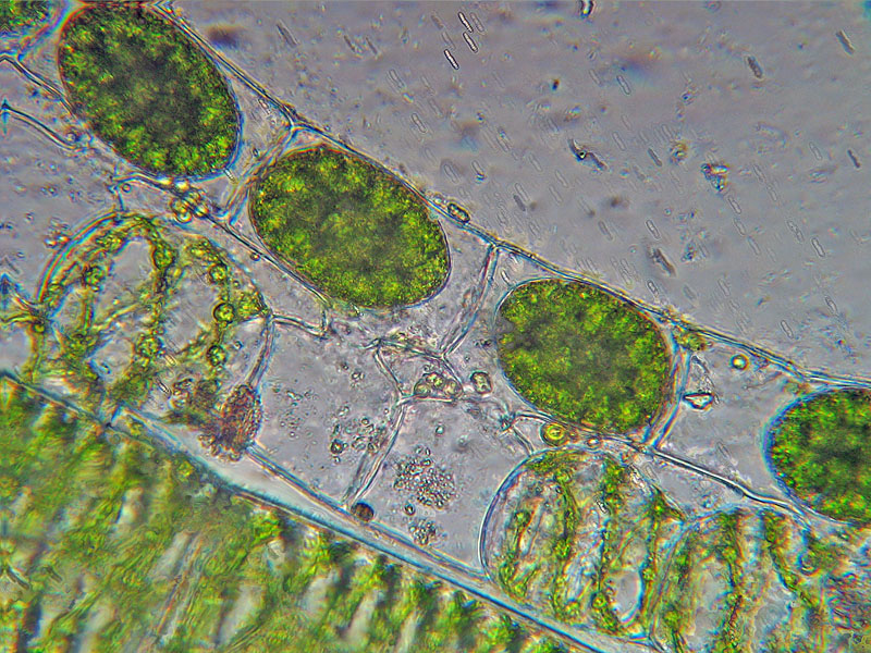 Coniugazione di Spirogyra